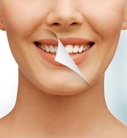 Cosmetic Dentistry SW Calgary | Monarch Landing Dental | Calgary, AB