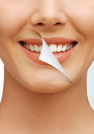Cosmetic Dentistry | Calgary Dental Clinic | Monarch Landing Dental | Calgary, AB