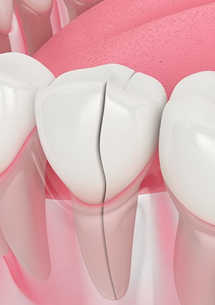 Restorative Dentistry Calgary | Monarch Landing Dental | Calgary, AB