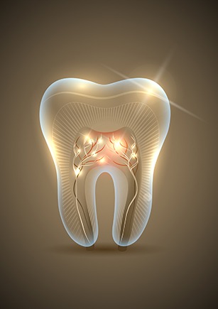 Root Canal Therapy Calgary | Monarch Landing Dental | Calgary, AB